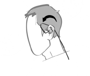 IEM insertion guide graphic