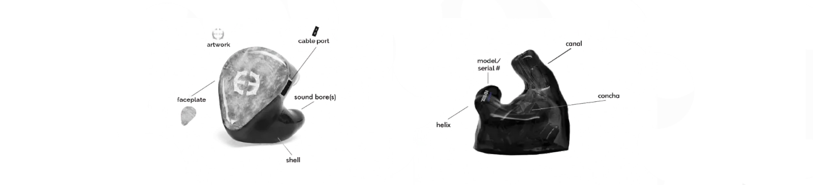 IEM anatomy diagram 
