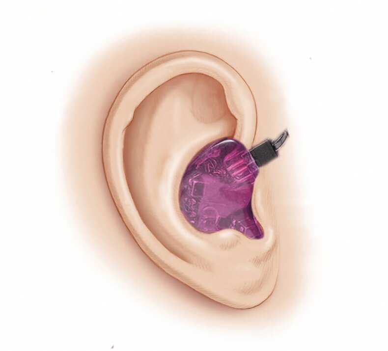 Picture of an ear with an IEM inside the ear canal