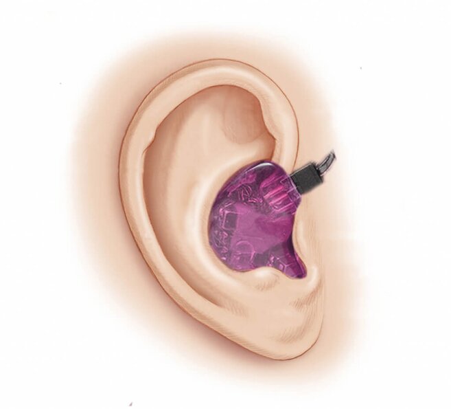 ear with an iem in it