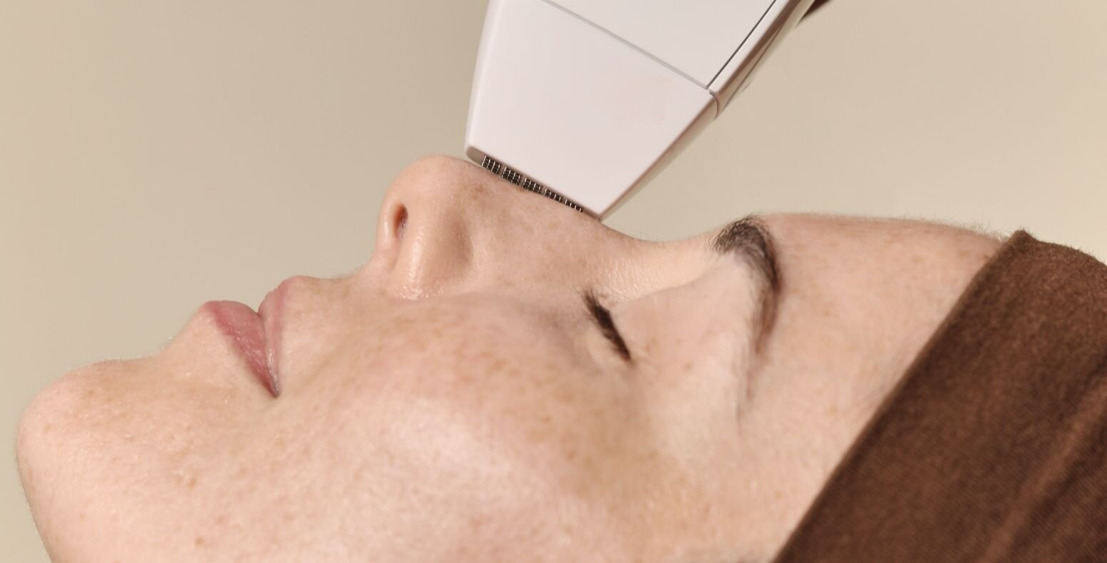 woman receiving a resurfacing facial
