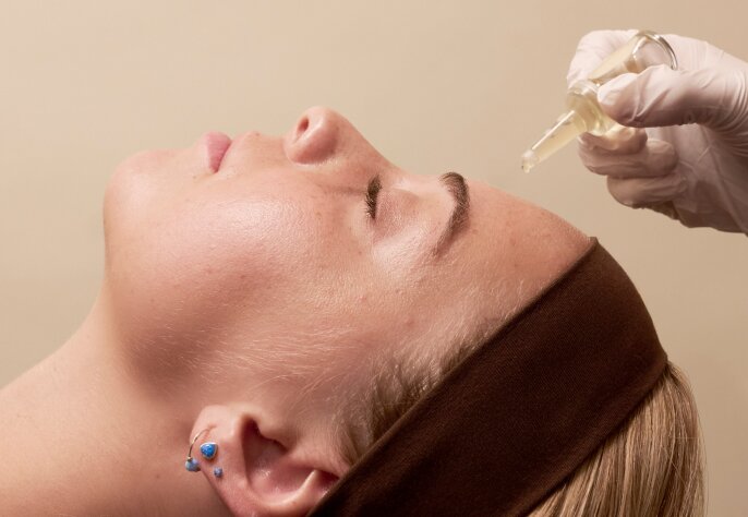 teen receiving facial peel for acne