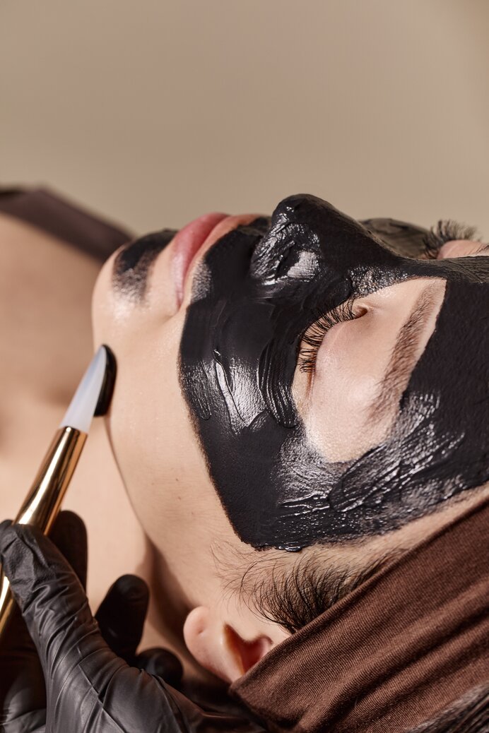 woman receiving a carbon peel