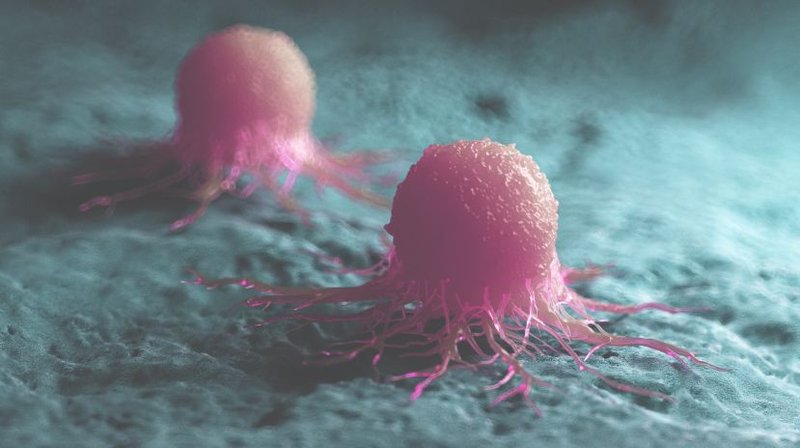 Fasting and cancer treatment in humans: A case series report