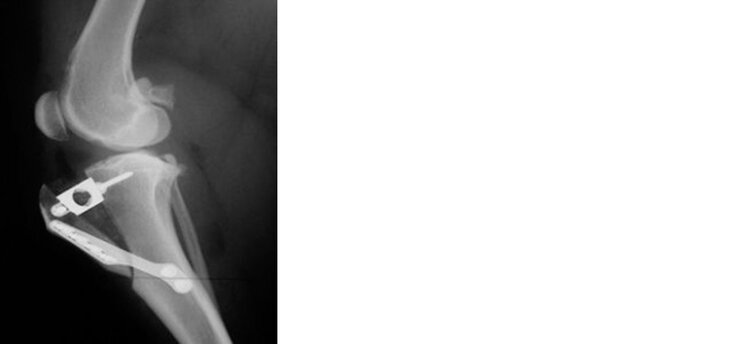 X-ray after TTA procedure