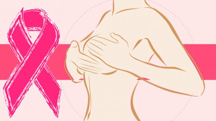 Ilustración de una mujer realizando una autoexploración mamaria junto a un lazo rosa, símbolo de concientización sobre el cáncer de mama.