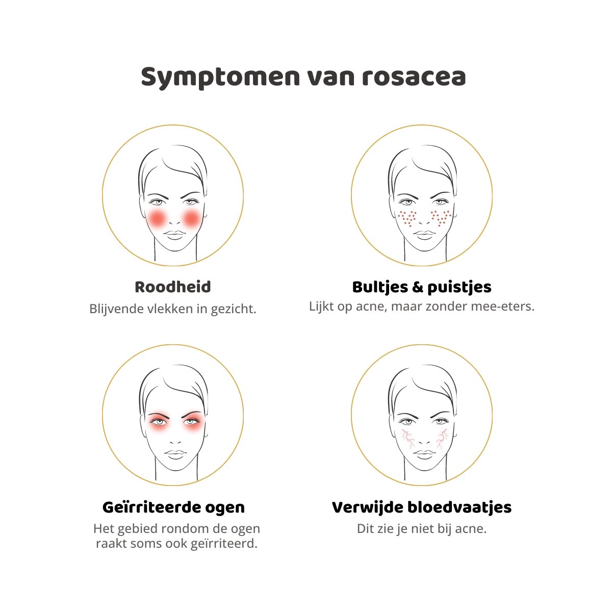 Symptomen rosacea