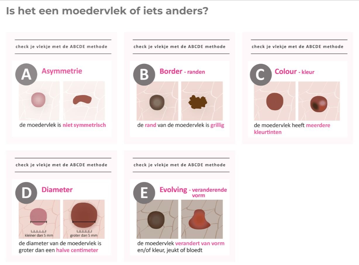 ABCDE-regel check je vlekje