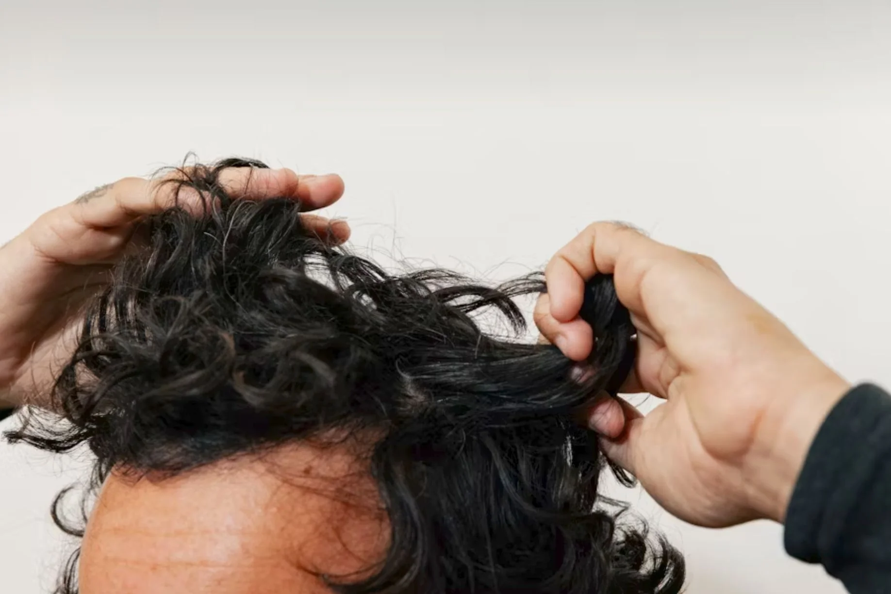 Die verschiedenen Formen von Haarausfall