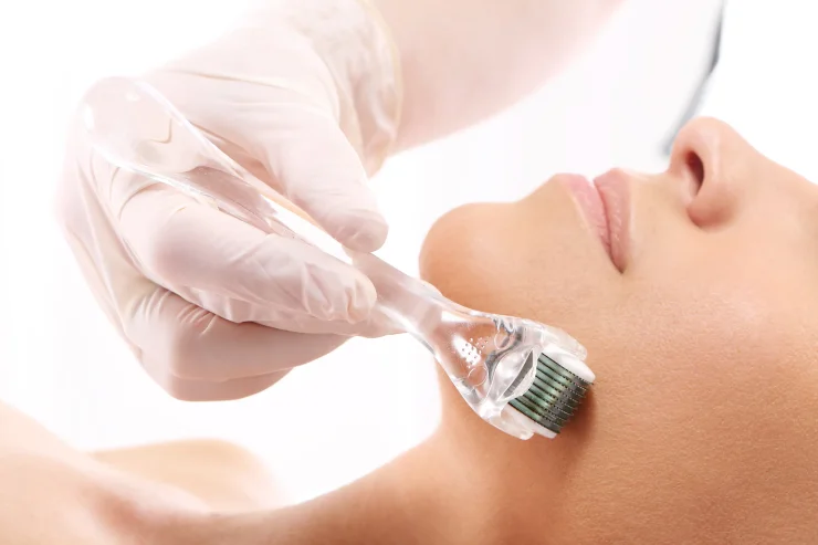 Licensed aesthetician performing microneedling on woman's skin