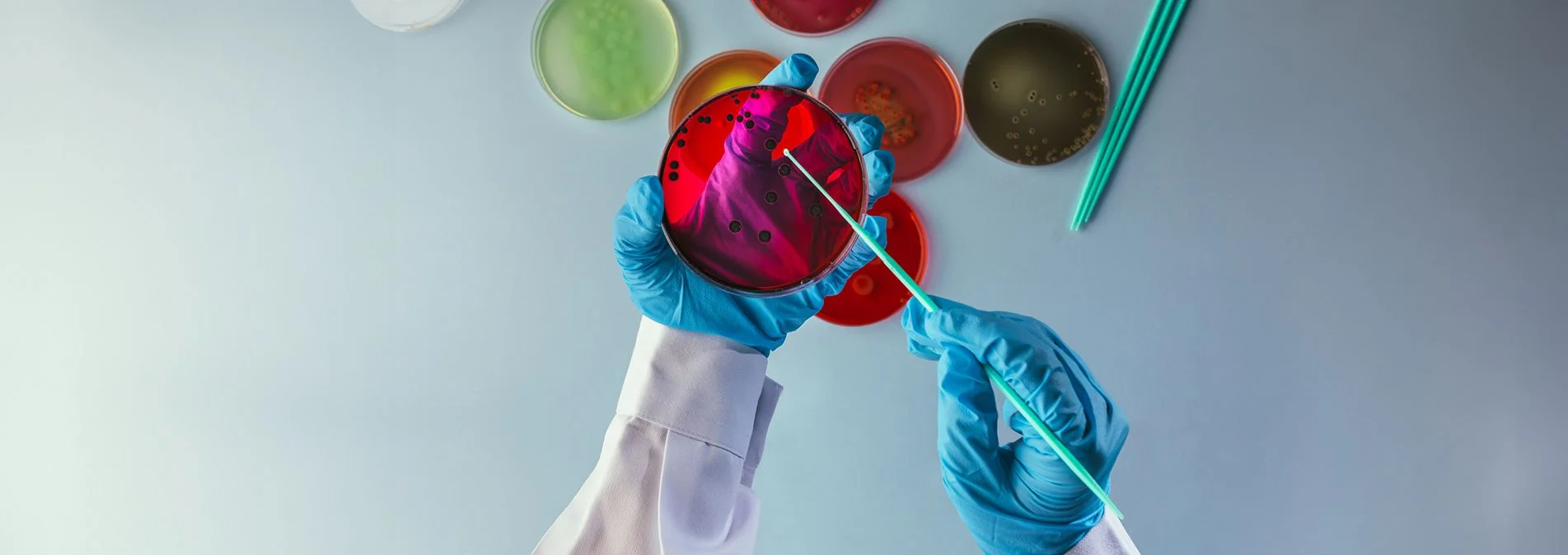 A woman's hands working with petri dishes containing bacteria in a lab.