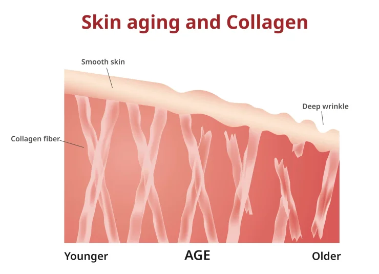 Graphic showing the decline of collagen with age.