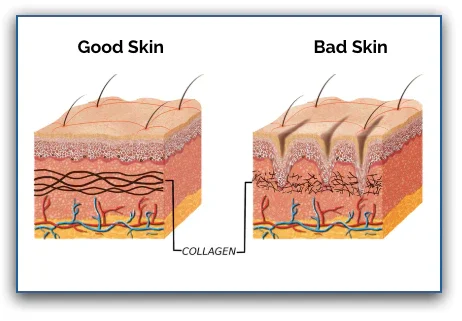Collagen Enhances Skin Complexion & Reduce Wrinkles