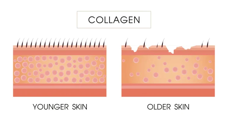 Graphic Showing Collagen in Younger Skin vs. Older Skin