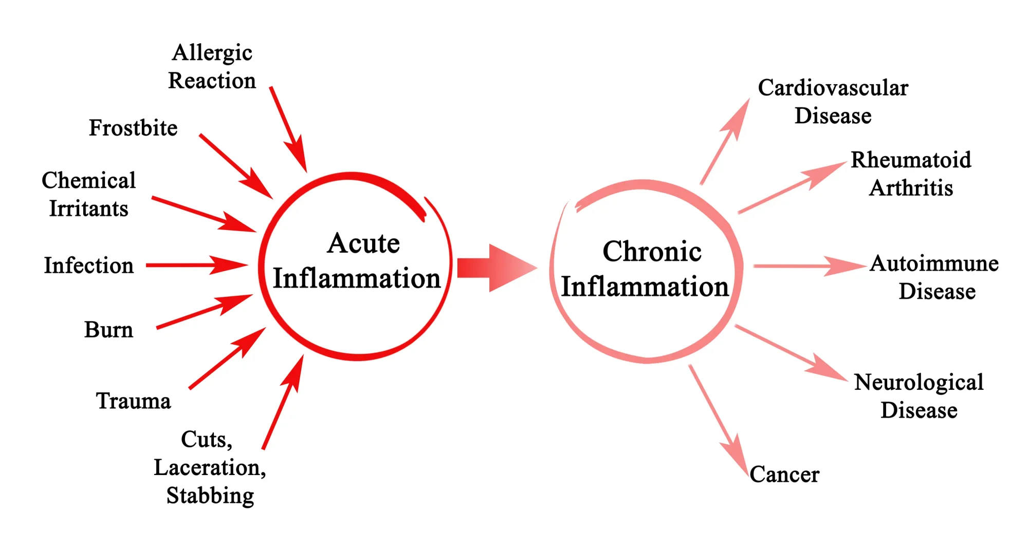 Acute Inflammation vs. Chronic Inflammation Graphic