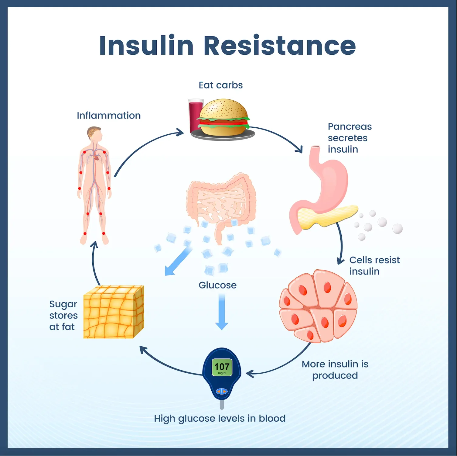 Graphic showing the steps of developing insulin resistance.