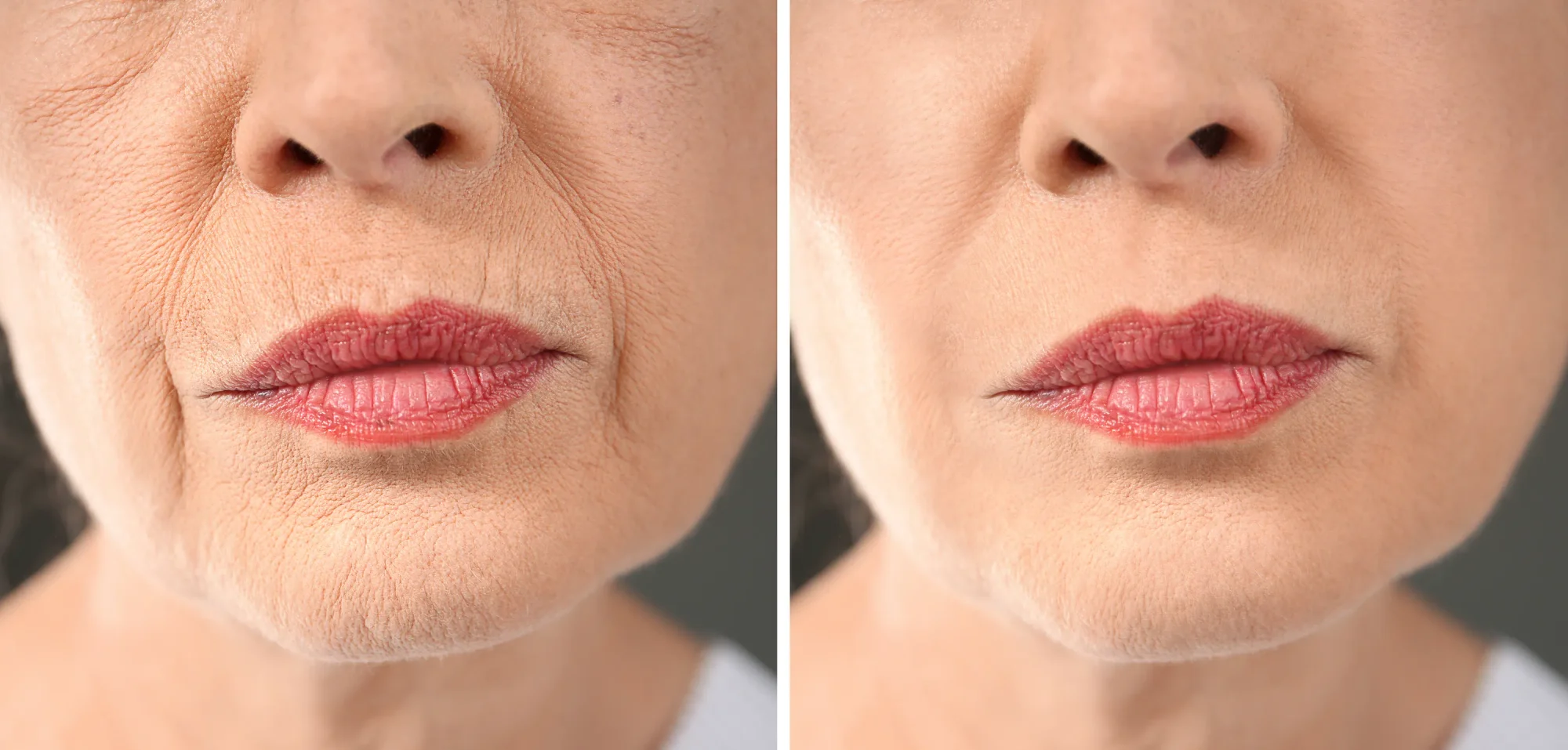 Close-up of senior woman's skin before and after.