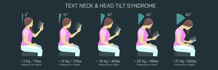 Vector drawing showing the amount of weight on a woman's spine as her head tilts forward