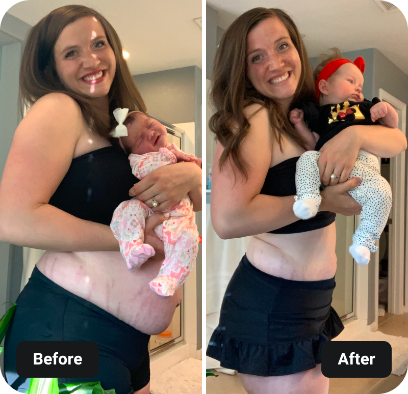 Pre & Post Natal Barre Blend results before and after