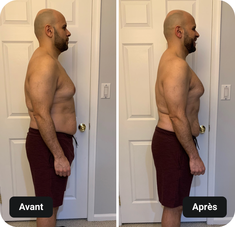 4 Week Gut Protocol Before and After