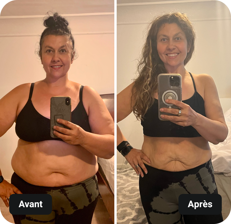 LIIFT MORE results before and after