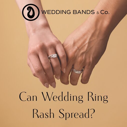 Hands wearing wedding bands and a diamond engagement ring illustrating wedding ring rash concerns