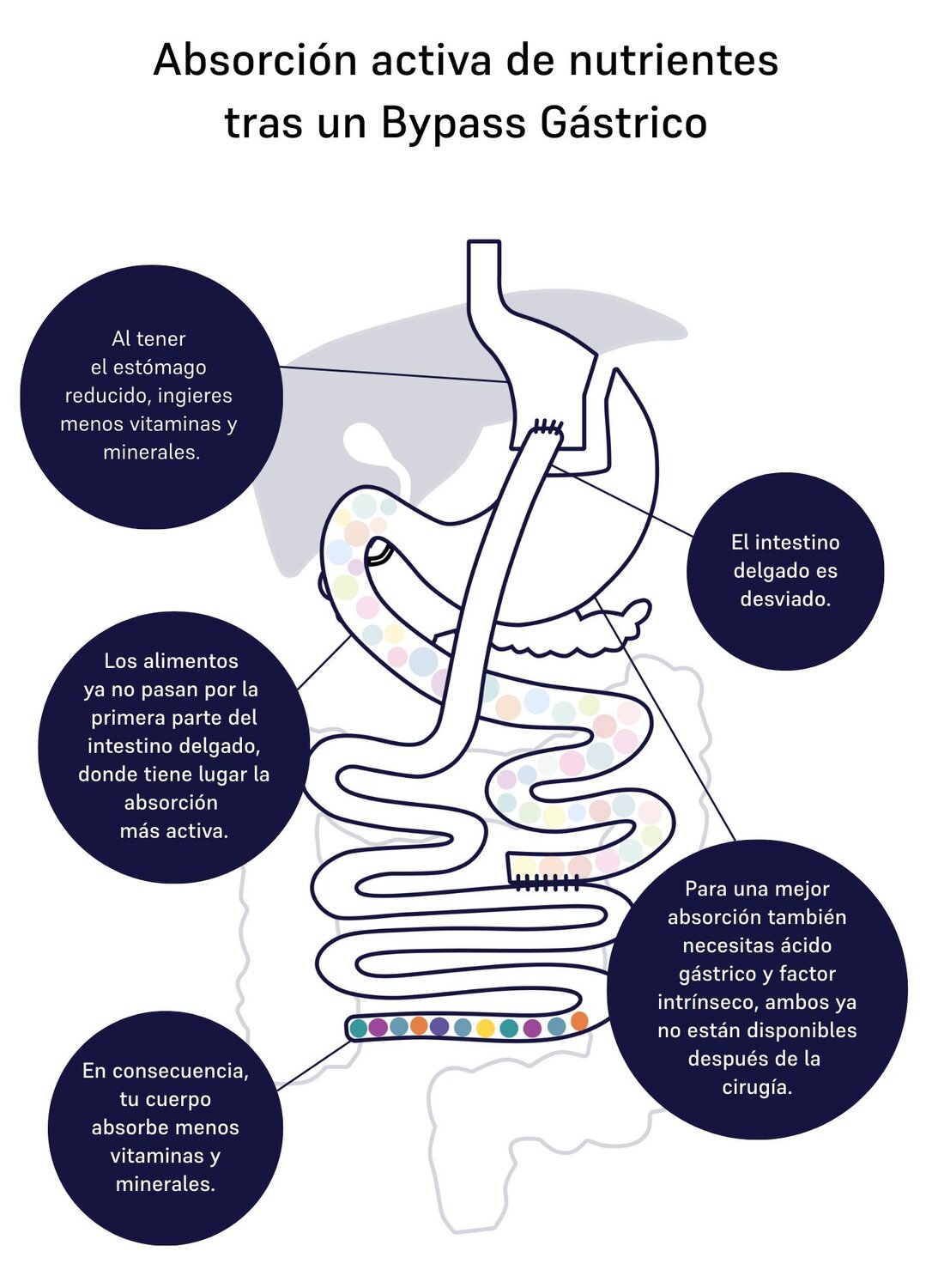 absorption of nutrients gastric bypass 
