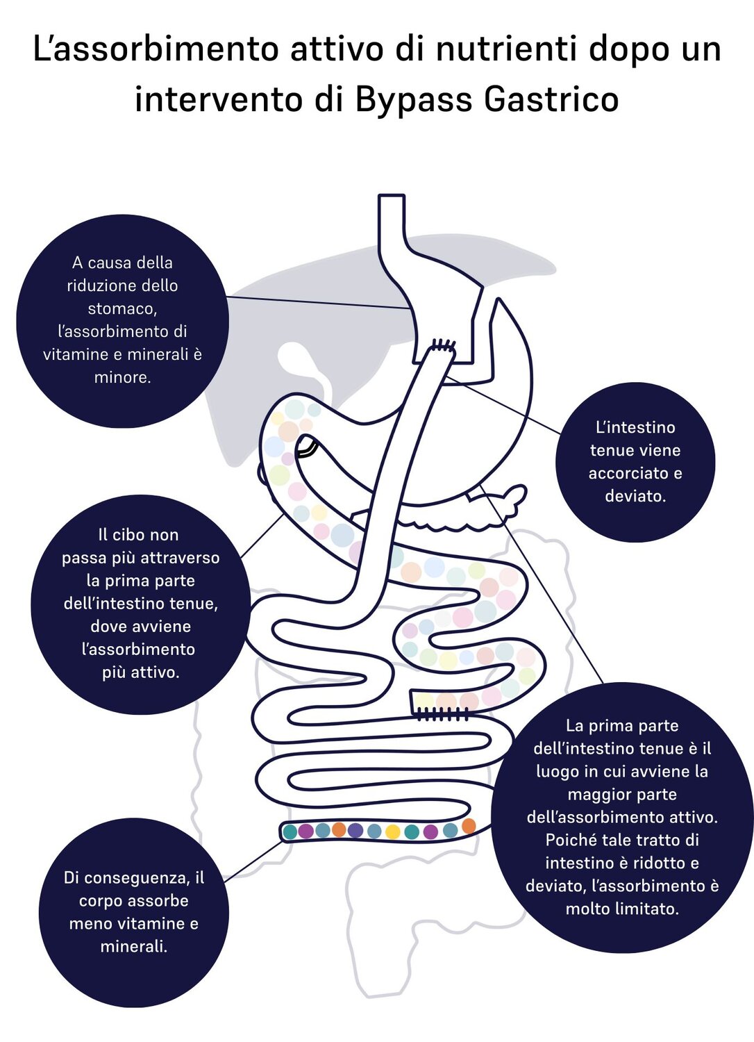 absorption of nutrients gastric bypass 
