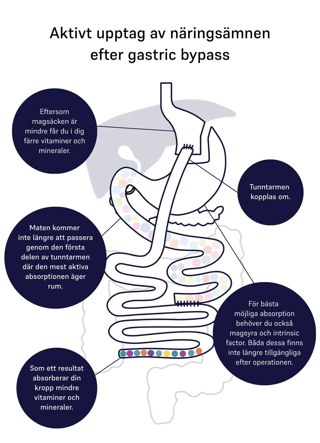 absorption of nutrients gastric bypass 