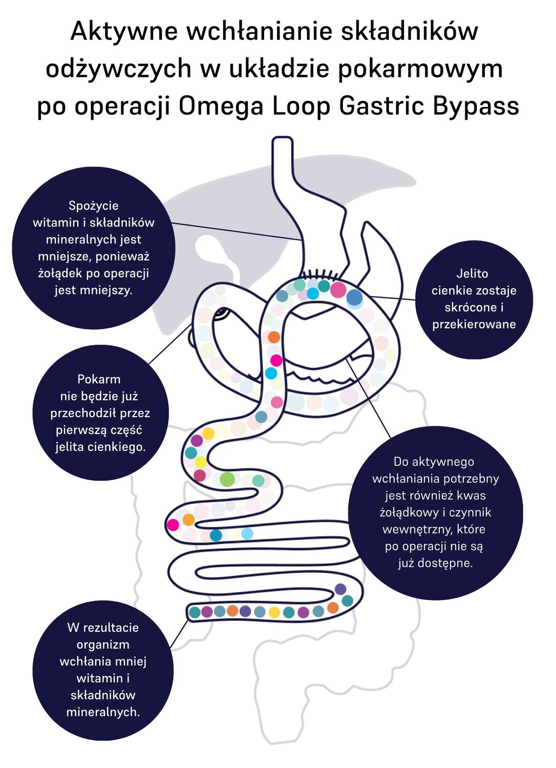 Image of absorption omega-loop 