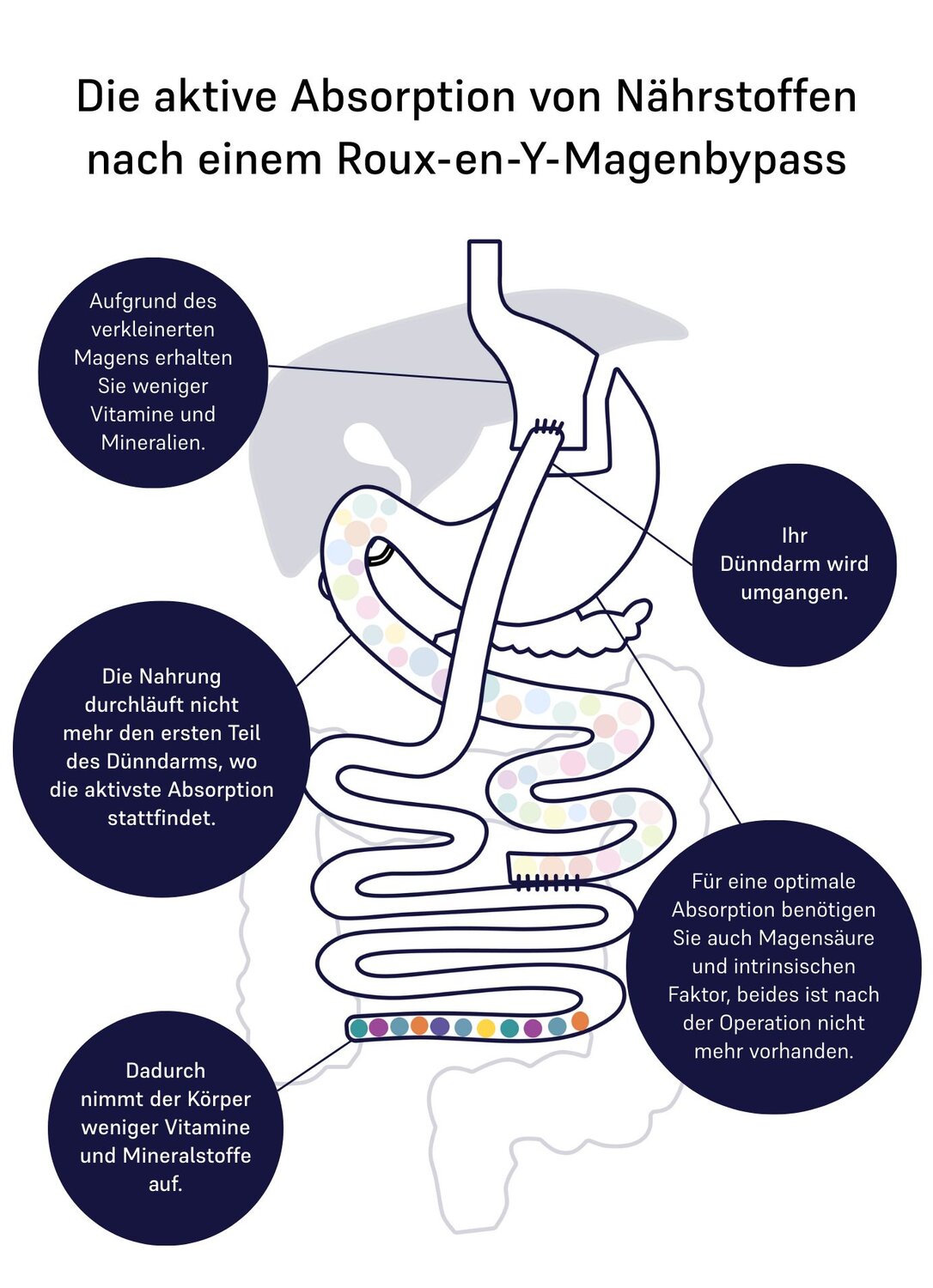 absorption of nutrients gastric bypass 