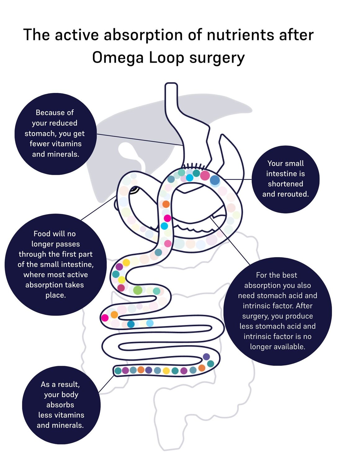 Image of absorption omega-loop 