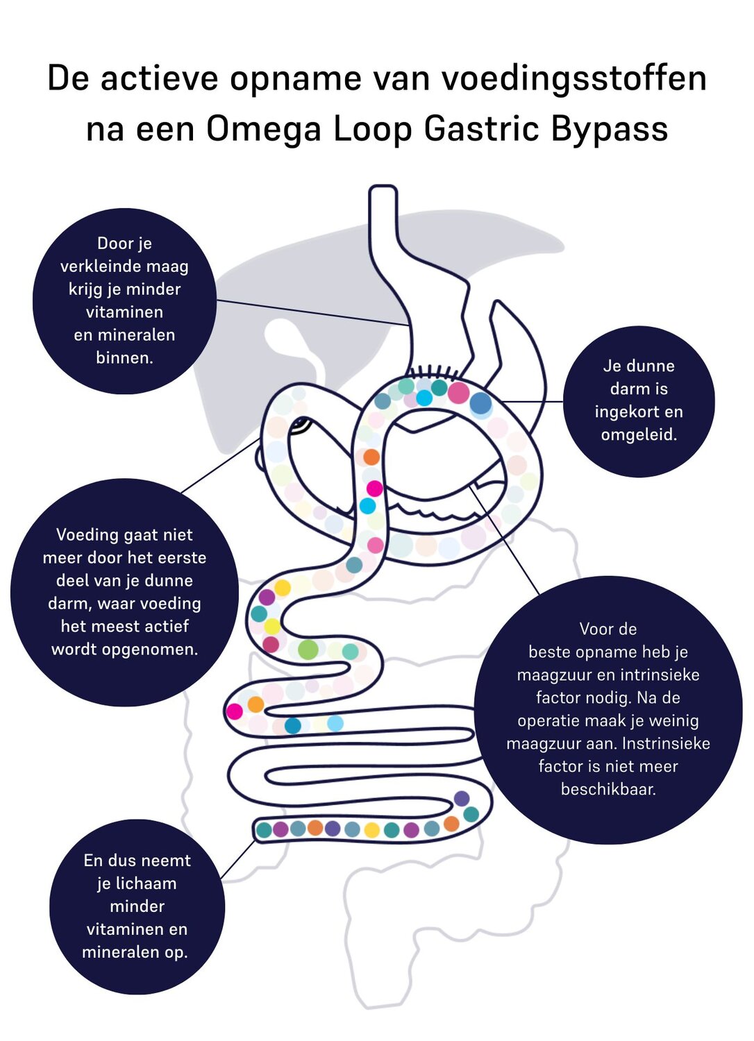 Image of absorption omega-loop 