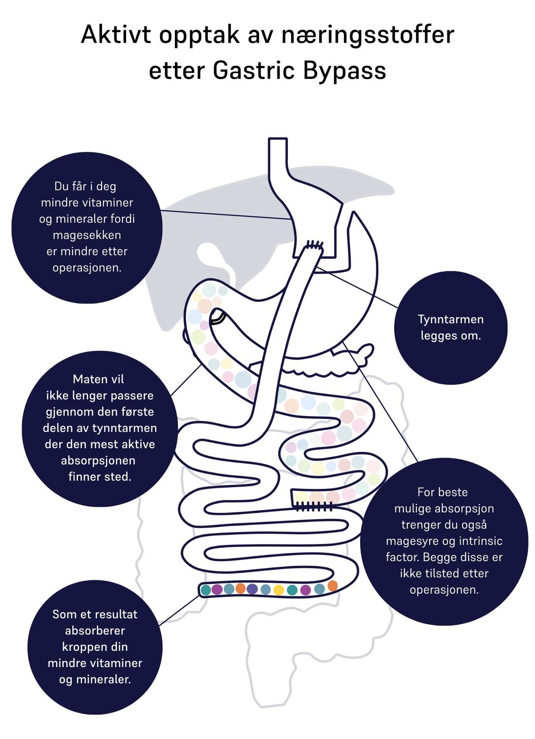 absorption of nutrients gastric bypass 