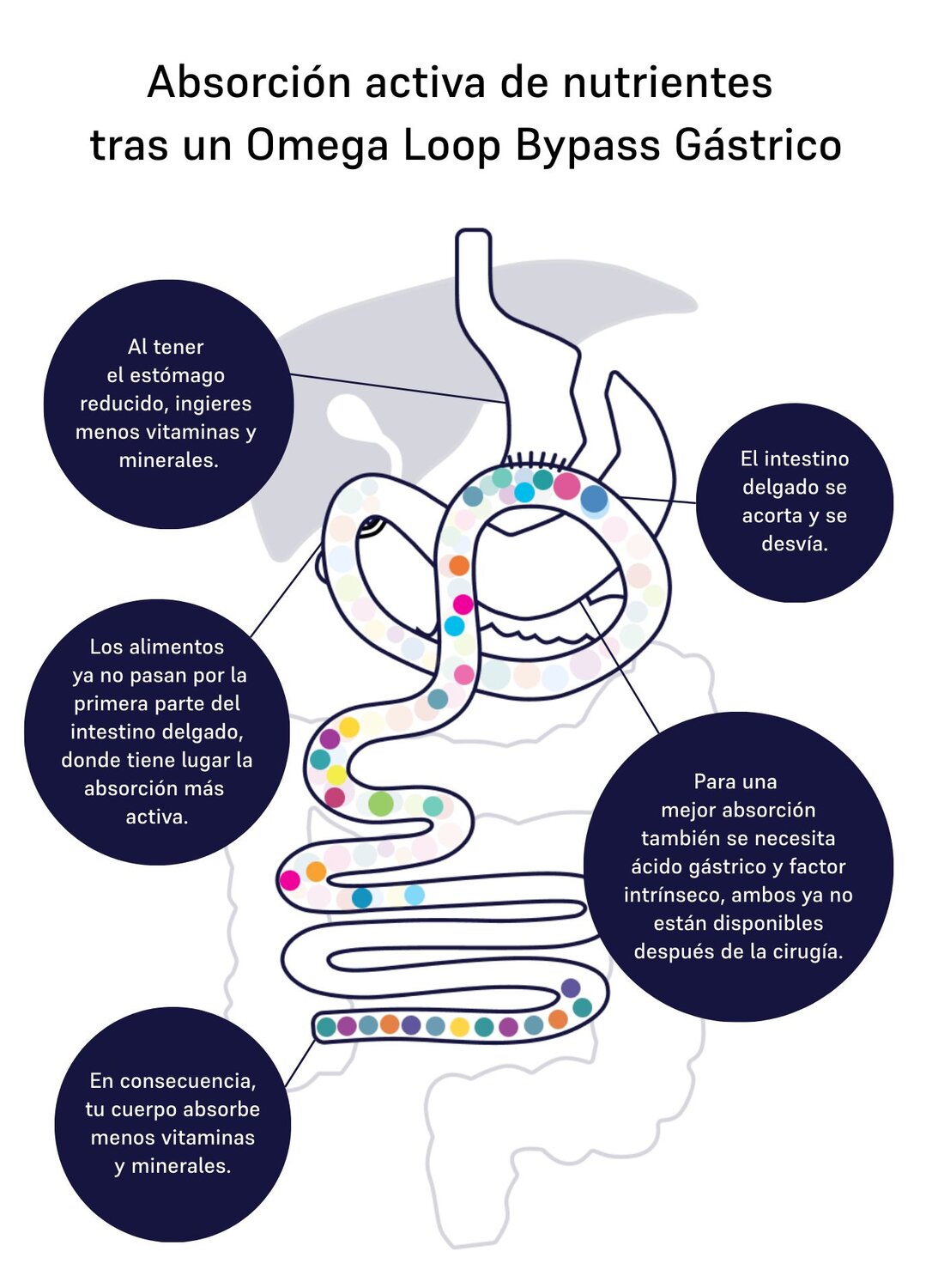 Image of absorption omega-loop 