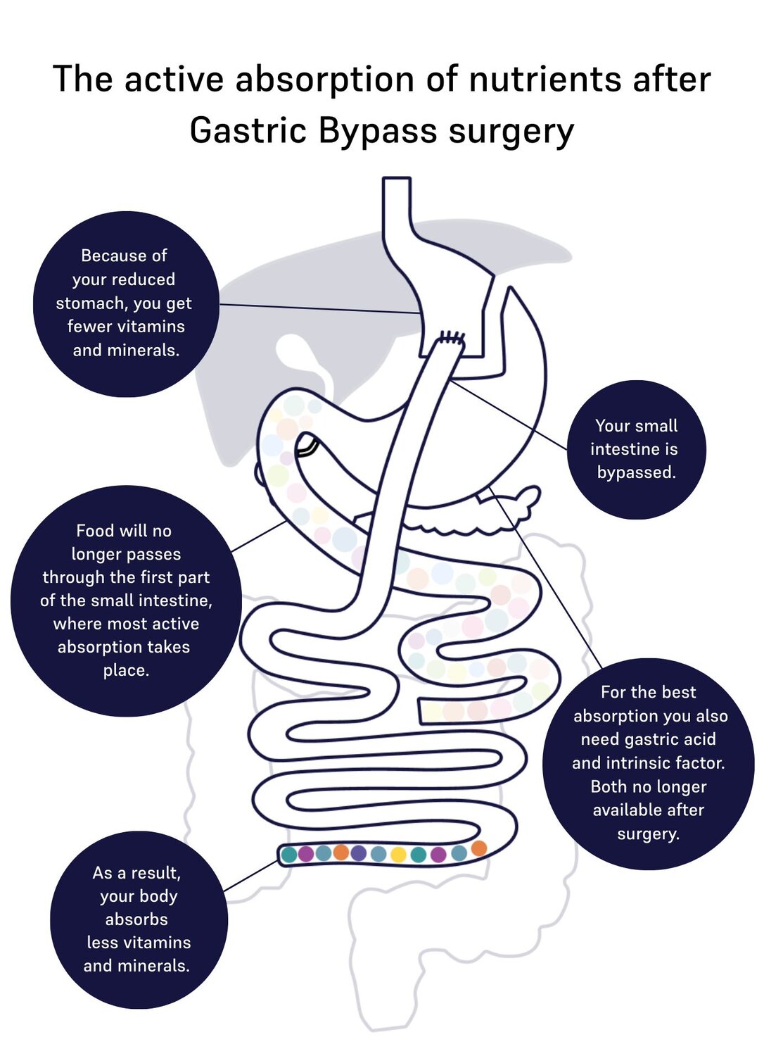absorption of nutrients gastric bypass 