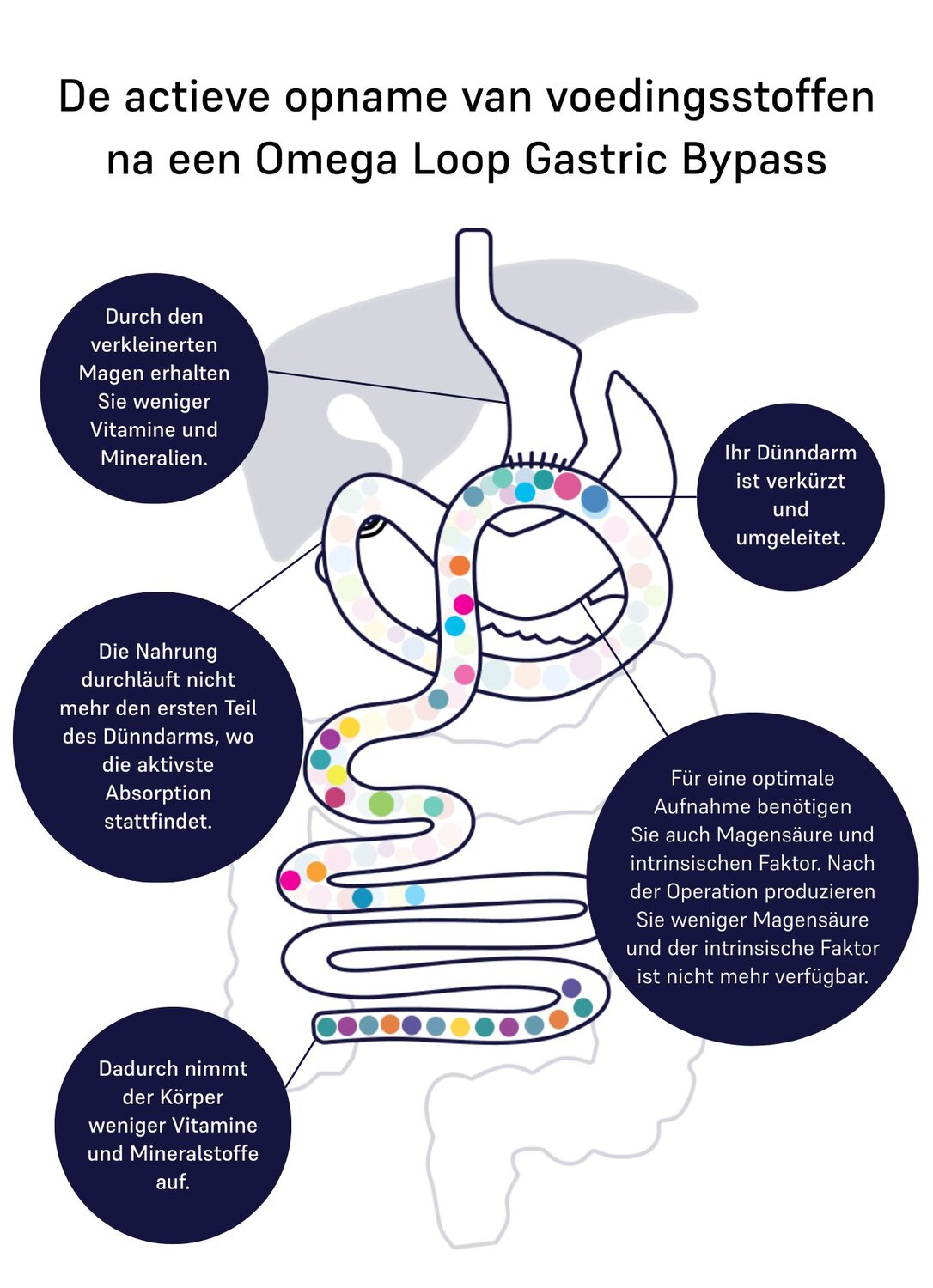 Image of absorption omega-loop 