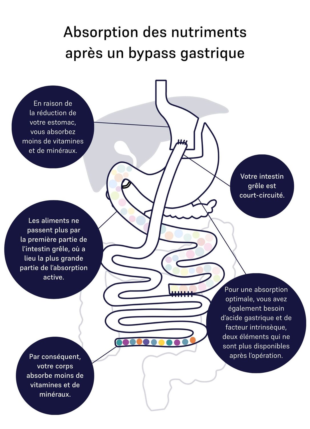 absorption of nutrients gastric bypass 