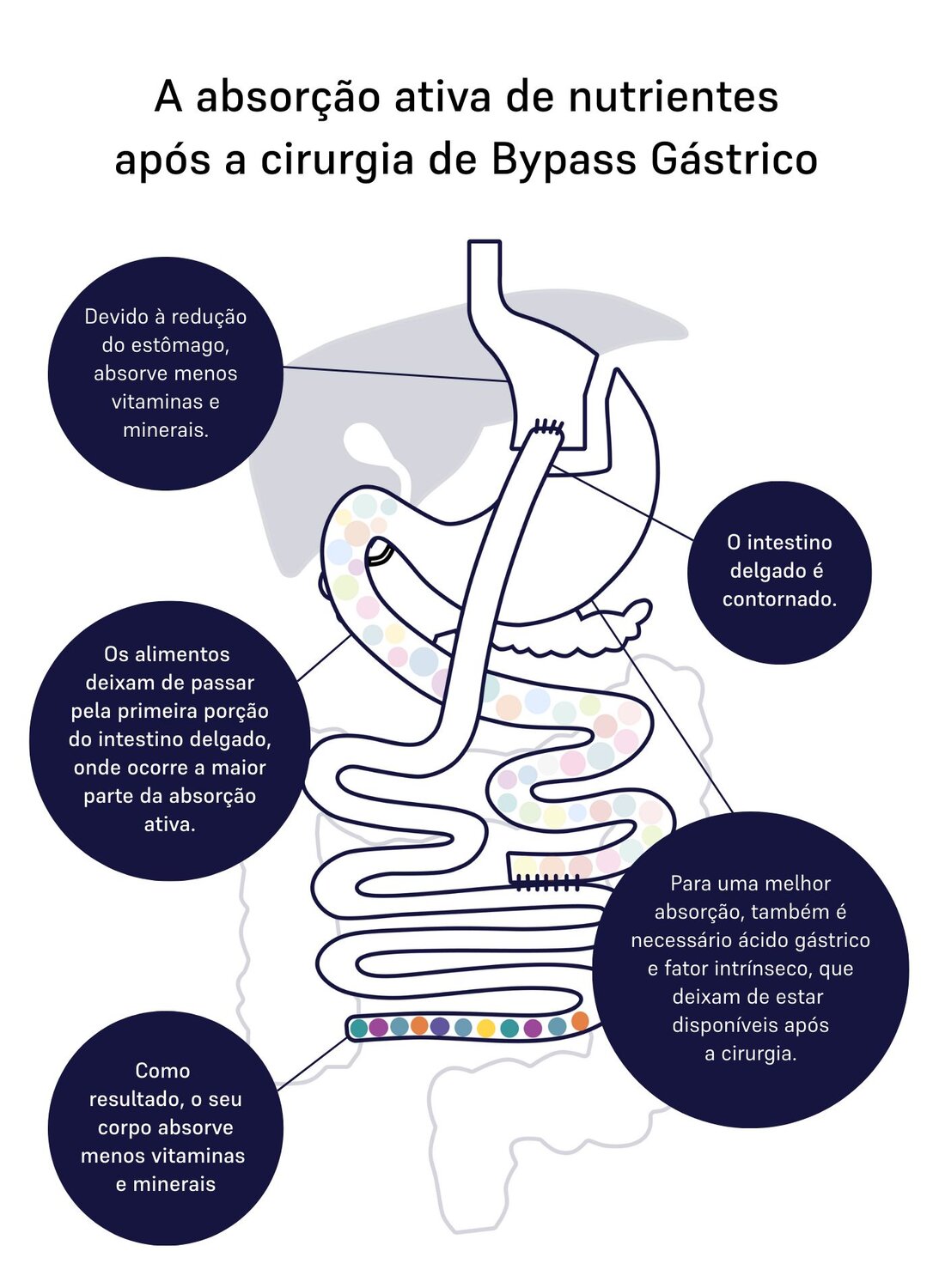 absorption of nutrients gastric bypass 