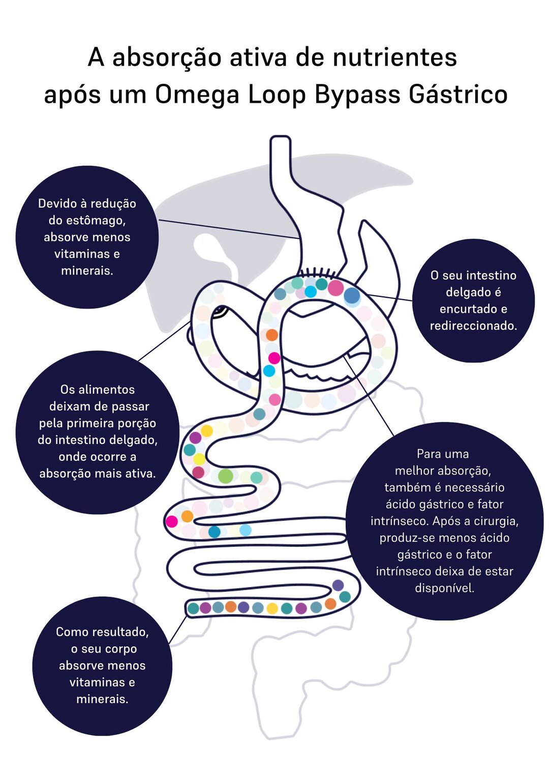 Image of absorption omega-loop 