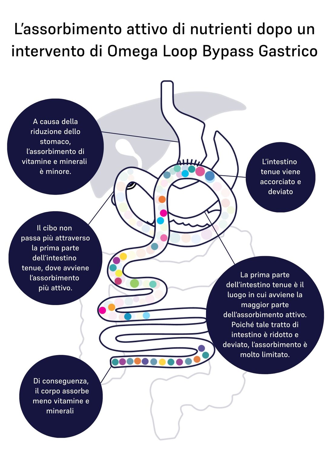 Image of absorption omega-loop 
