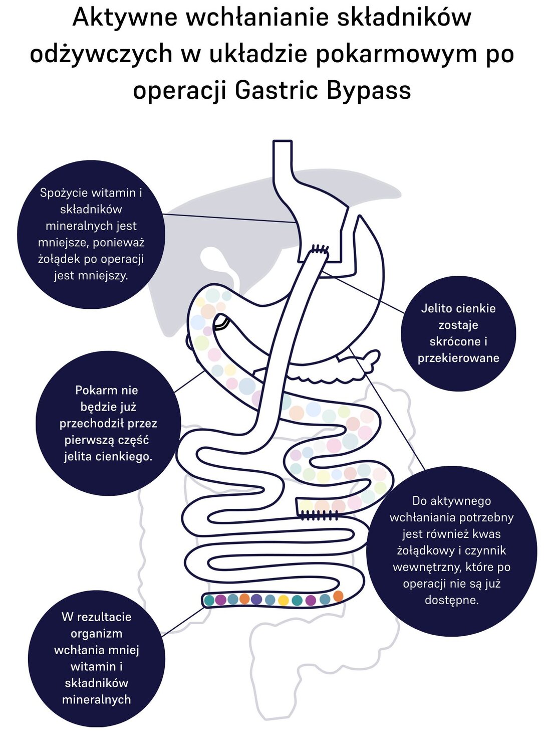 absorption of nutrients gastric bypass 
