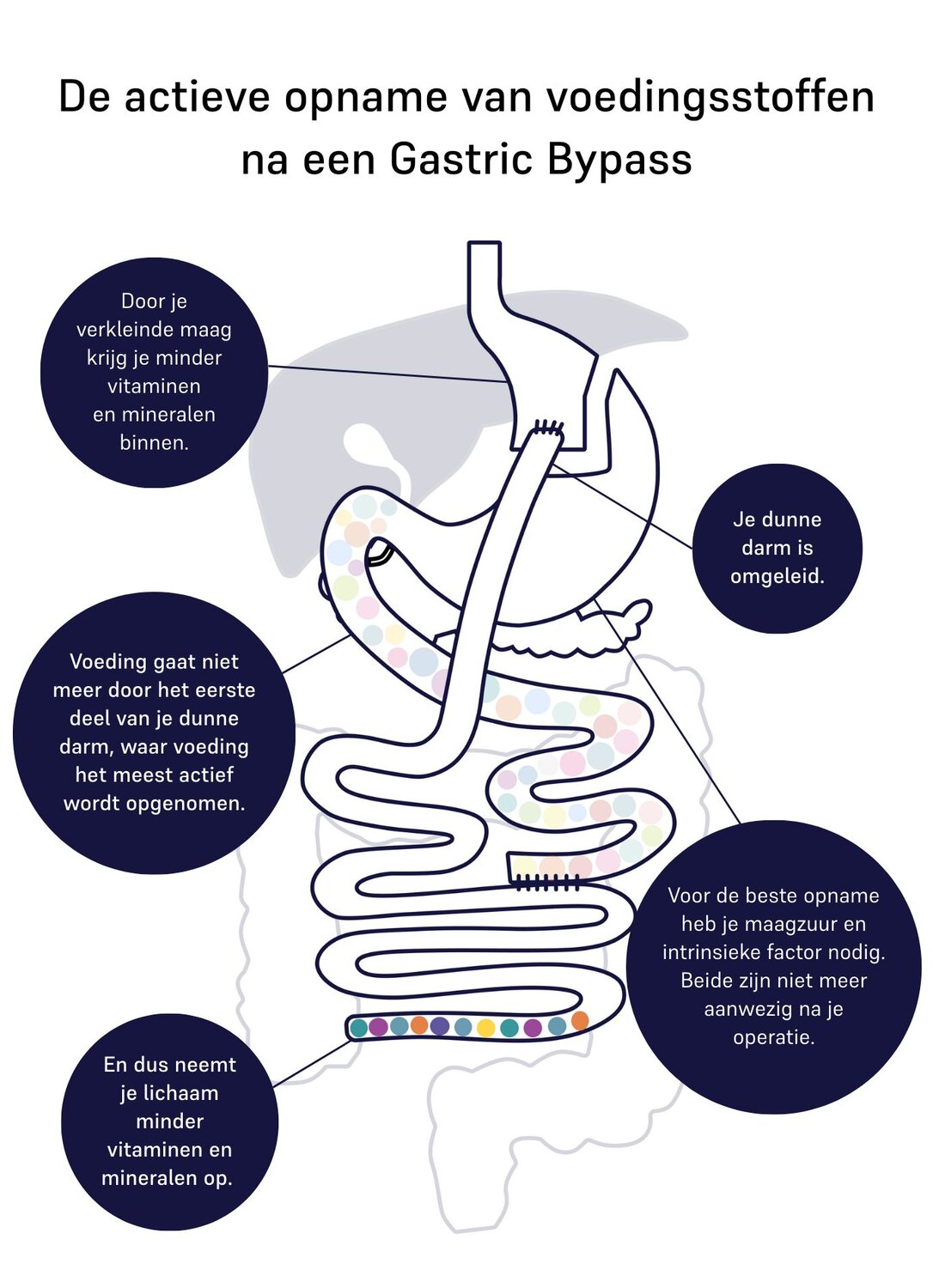 absorption of nutrients gastric bypass 