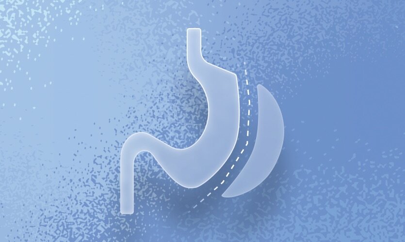 WLS Optimum, your multivitamin for Gastric Sleeve