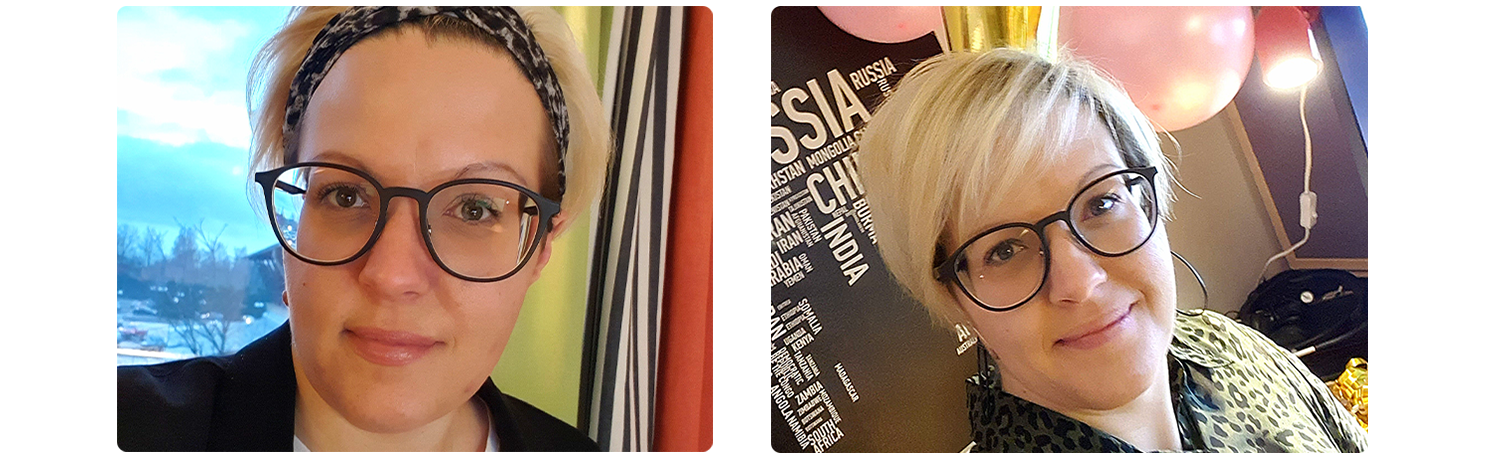 Picture before and after surgery