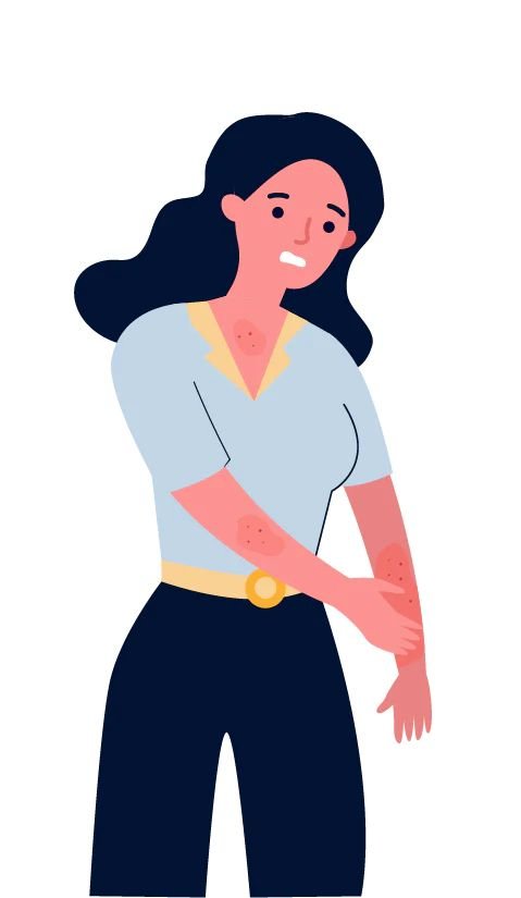 Illustration of woman scratching arm rash from scabies