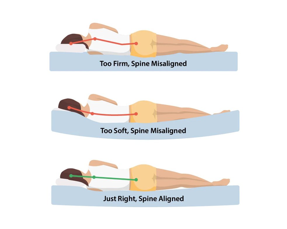 Illustration showing misalignment vs. proper spine alignment while sleeping