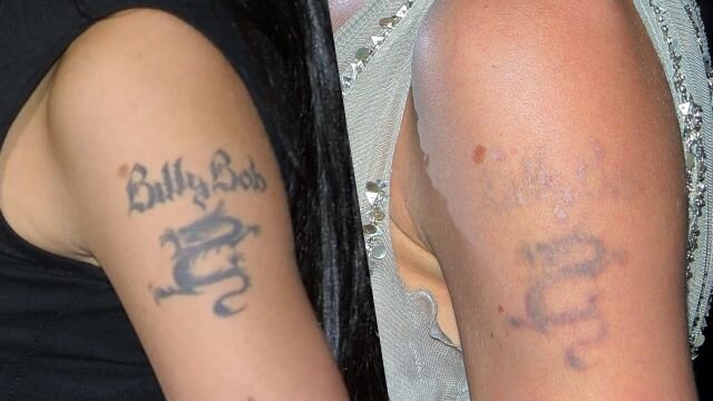 Famosos que removeram tatuagem de ex - Angelina Jolie