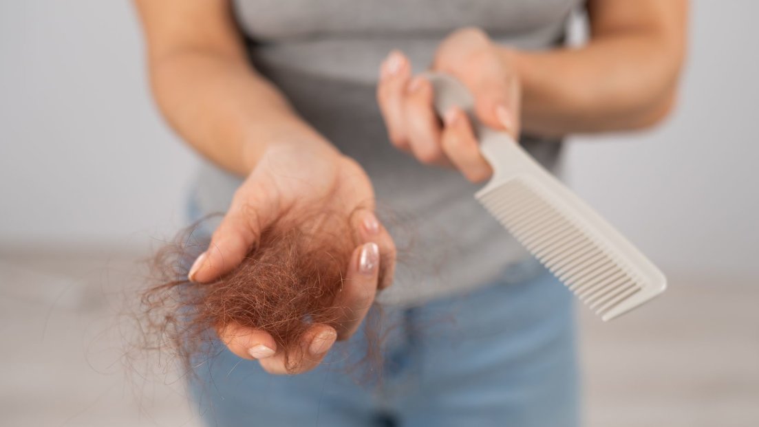 Women holding a comb and lost hair