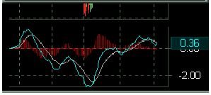 Lightspeed Trader moving average convergence/divergence